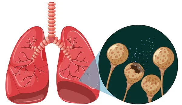 Diseases
